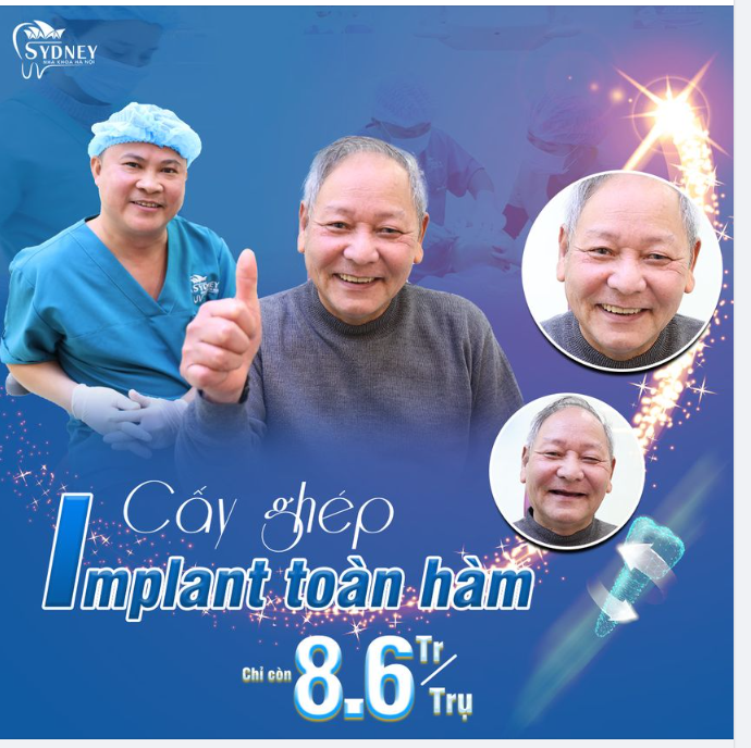 Ưu điểm cấy răng toàn hàm
