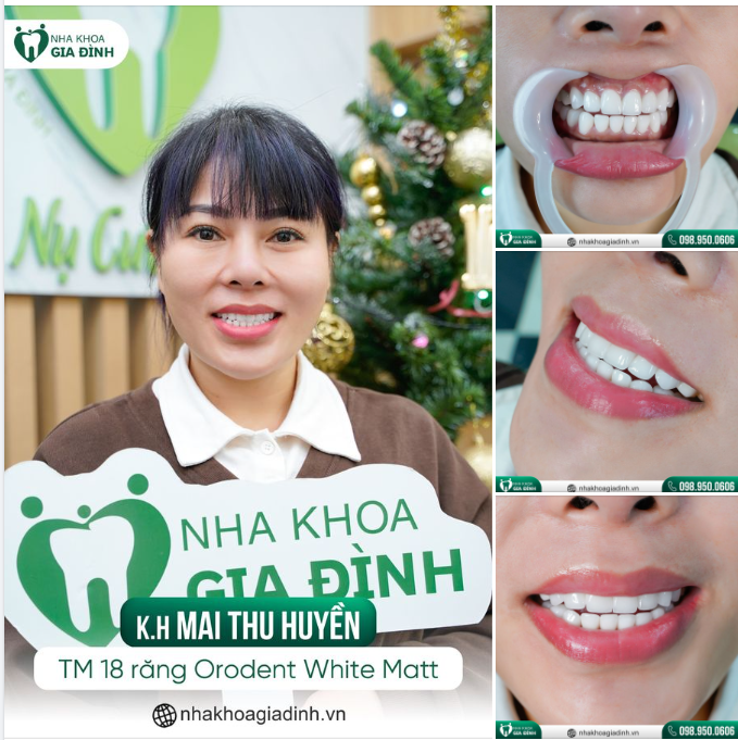 RẤT NHIỀU NGƯỜI MƠ ƯỚC CÓ HÀM RĂNG ĐẸP NHƯ THẾ NÀY!!!