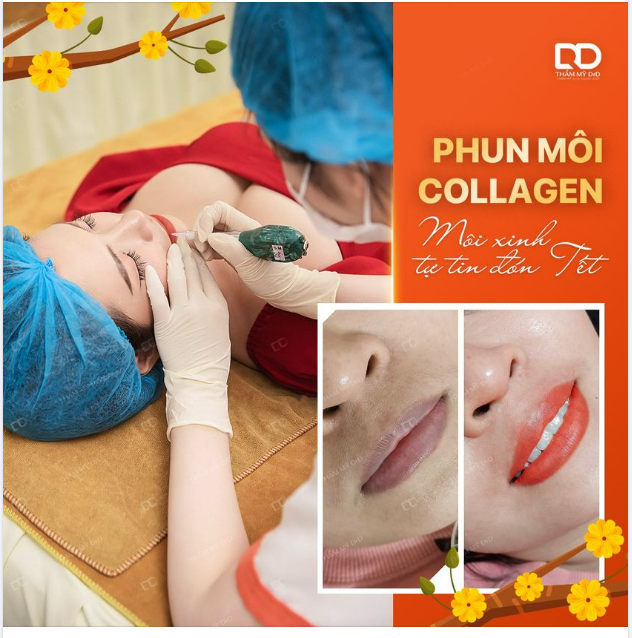 PHUN MÔI COLLAGEN - MÔI XINH TỰ TIN ĐÓN TẾT