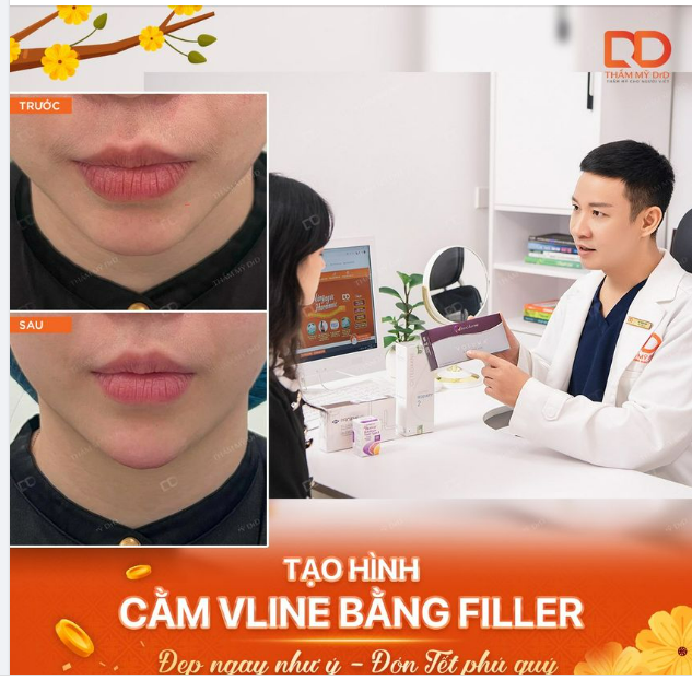 KHÔNG CẦN ĐỘN CẰM VẪN CÓ NGAY CẰM VLINE