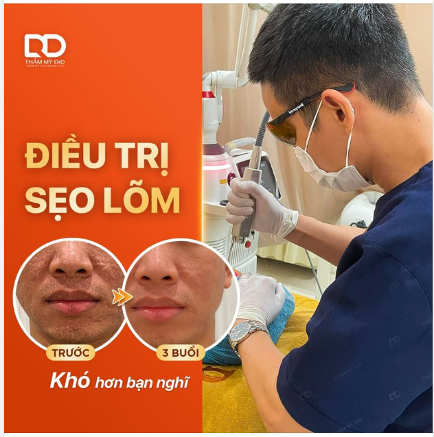 ĐIỀU TRỊ SẸO LÕM - KHÓ HƠN BẠN NGHĨ.