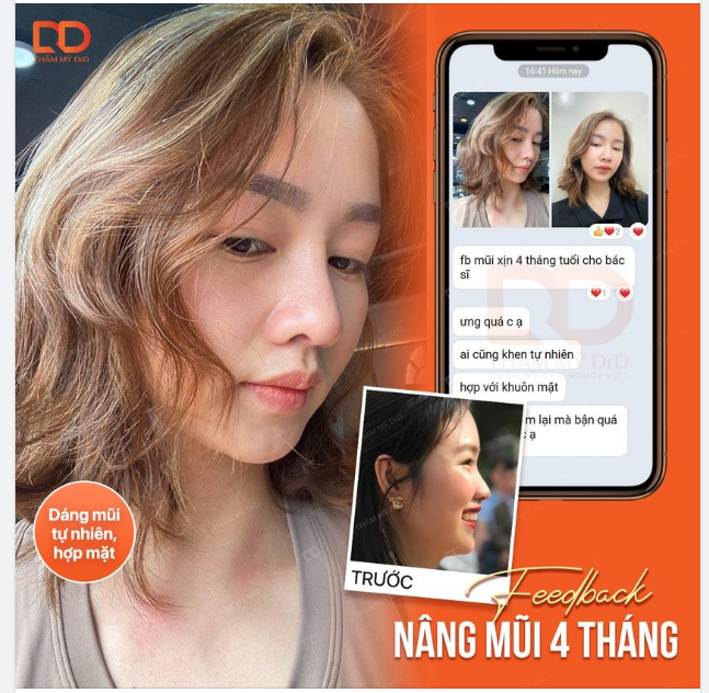 NÂNG MŨI MỚI - ĐỔI PHONG THUỶ - TÀI LỘC ĐẾN
