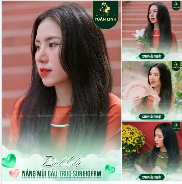 MŨI CAO TỰ NHIÊN TỰ TIN KHOE GÓC NGHIÊNG ''THẦN THÁNH''.