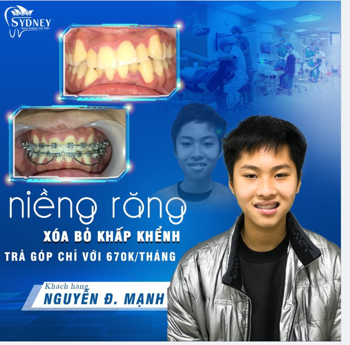 Răng khỏe cười xinh – Tự tin tỏa nắng