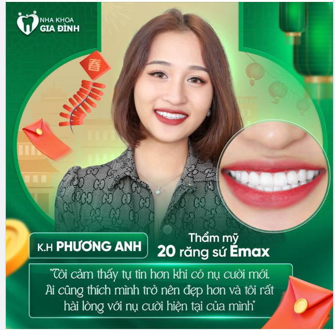NĂM MỚI TỰ TIN VỚI NỤ CƯỜI HOÀN HẢO