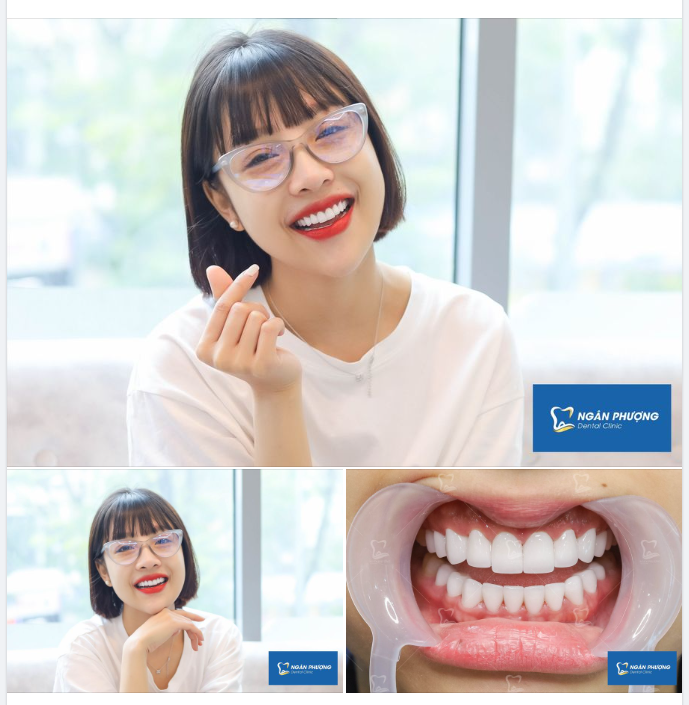 Muốn bình yên thì năng cầu chúc  Muốn cười xinh hạnh phúc thì làm răng với Nha khoa Ngân Phượng