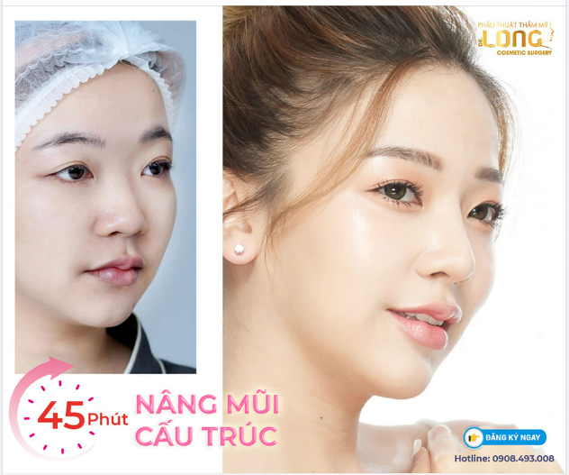 KHI VŨ TRỤ GỬI TÍN HIỆU CẦN PHẢI ĐI NÂNG MŨI VÀ SAU ĐÓ SẼ CÓ KHUÔN MẶT THÀNH RA NHƯ VẦY ĐÂY