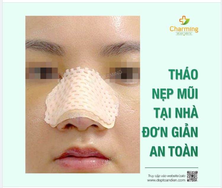 THÁO NẸP MŨI LÓT SỤN TẠI NHÀ VẪN AN TOÀN