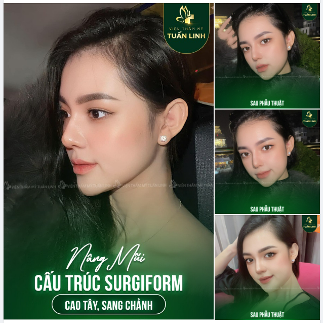 Đốn gục mọi con tim, thao túng triệu tâm hồn chỉ với chiếc mũi cao tây sang chảnh chuẩn Hotgirl!!