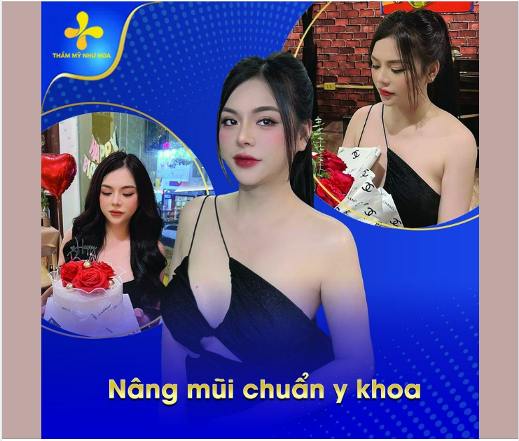 Kết quả khác biệt ngay sau khi nâng mũi tại Thẩm mỹ Như Hoa: