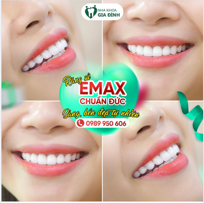RĂNG ĐẸP TỰ NHIÊN – ĐỘ CHỊU LỰC GẤP 5 LẦN RĂNG THẬT