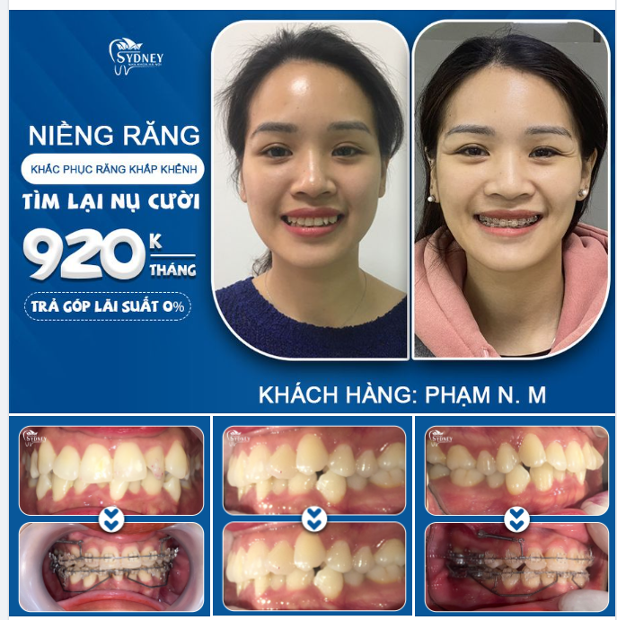 Thật lãng phí một ngày nếu không có tiếng cười