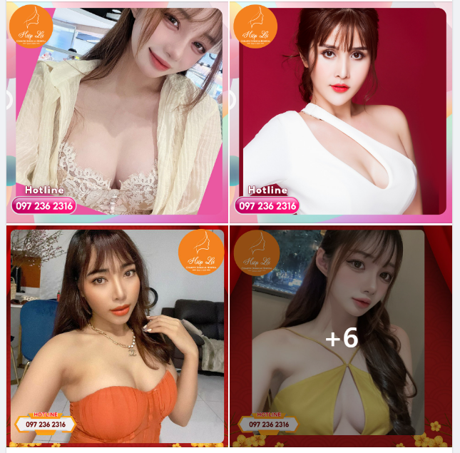 Cải thiện ngoại hình với phương pháp nâng V1 mới nhất tại Hiệp Lợi