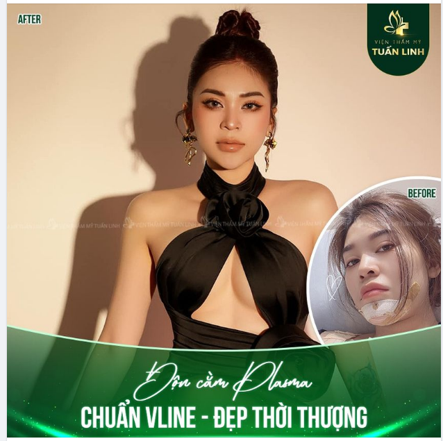 "Mặt đẹp, cằm xinh nhìn là muốn chung tình với cô ấy ​​​​​​​"
