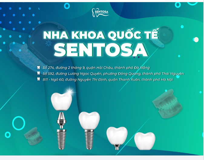 ĐỊA CHỈ TRỒNG RĂNG IMPLANT UY TÍN TẠI ĐÀ NẴNG HÀ NỘI/ THÁI NGUYÊN?