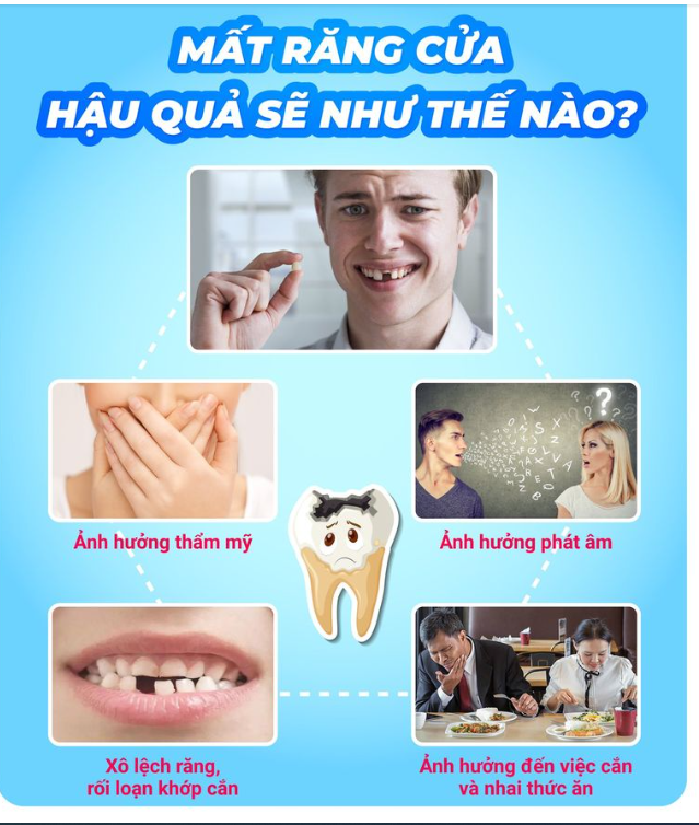 Mất răng cửa - hậu quả sẽ như thế nào?