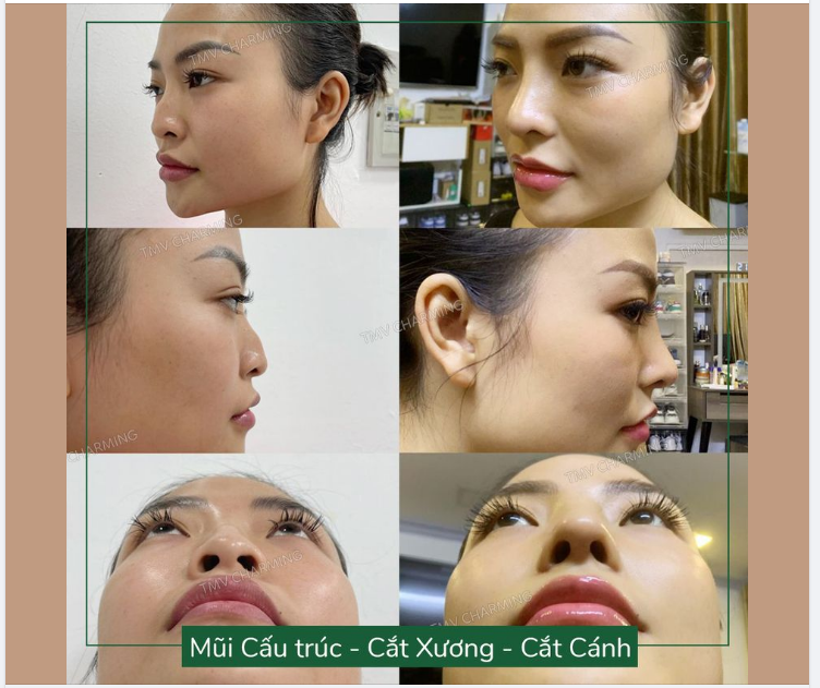 Tôi năm nay bao-nhiêu-tuổi-thì-không-nói-đâu, nhưng tôi chưa thấy một trường hợp feedback nào mà chuyên nghiệp như này cả
