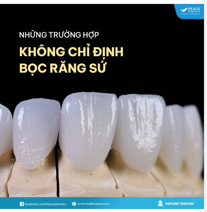 NHỮNG TRƯỜNG HỢP KHÔNG PHÙ HỢP CHỈ ĐỊNH BỌC RĂNG SỨ THẨM MỸ