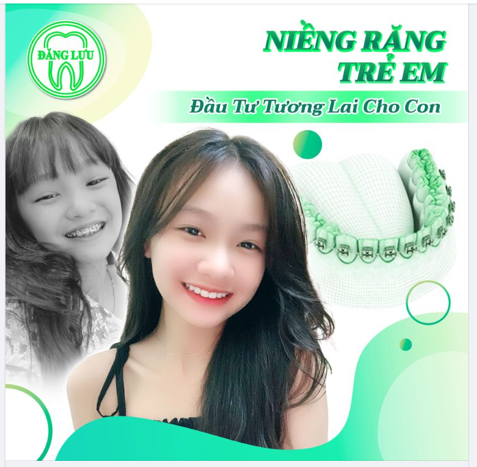 Thẩm mỹ nụ cười cho con tự tin tỏa sáng