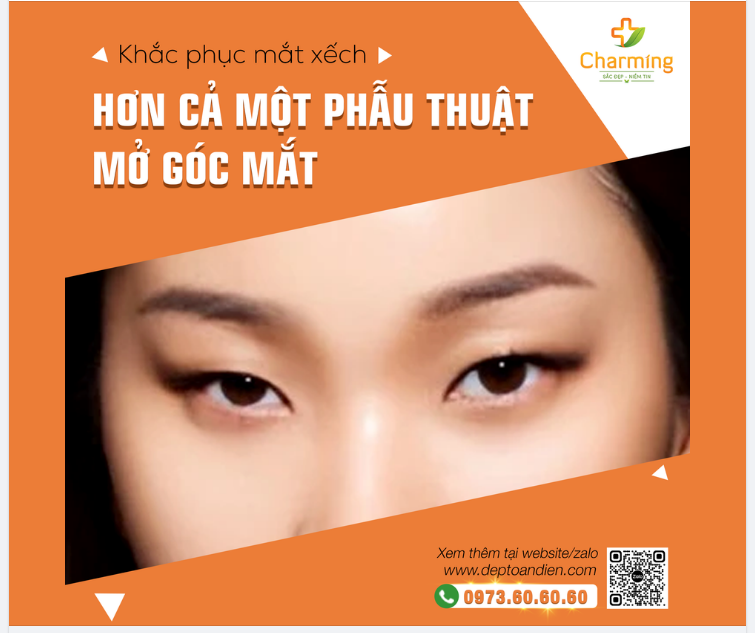KHẮC PHỤC MẮT XẾCH KHÔNG CHỈ LÀ PHẪU THUẬT MỞ GÓC MẮT