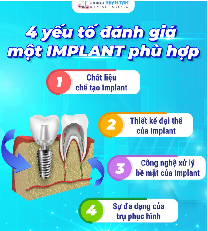 Răng Implant được coi là giải pháp ưu việt nhất trong các phương pháp phục hồi lại răng mất, hư hỏng giúp người mất răng lấy lại nụ cười tự tin và khả năng ăn nhai.