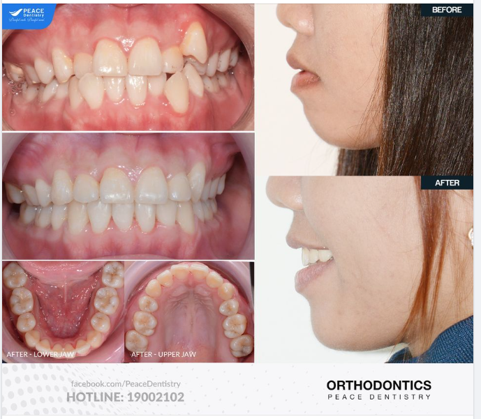 TÁI KHÁM ĐỊNH KỲ - CÁC LƯU Ý MÀ ĐỒNG NIỀNG CẦN BIẾT