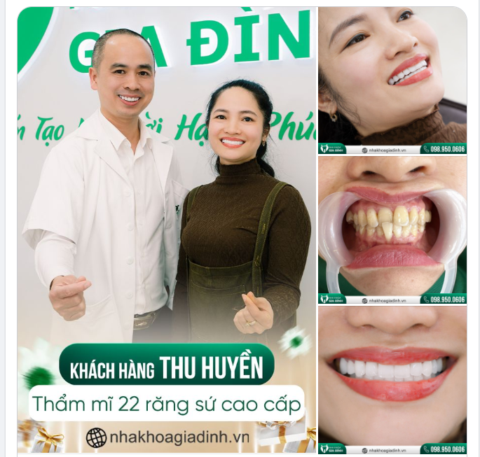 THAY ĐỔI DIỆN MẠO TỰ TIN HƠN RẠNG RỠ VỚI NỤ CƯỜI VẠN NGƯỜI MÊ