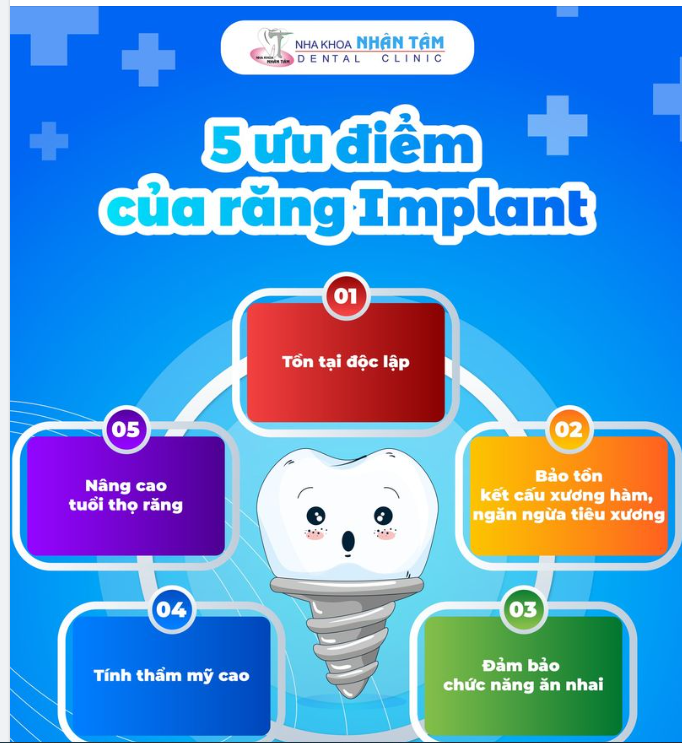 5 ưu điểm của răng Implant