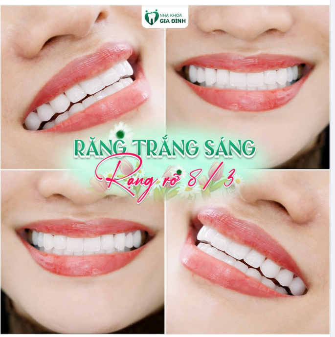 RĂNG TRẮNG SÁNG - RẠNG RỠ 8/3
