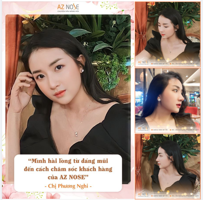 "Để có được dáng mũi này, mình phải cảm ơn Bác Nam và AZ NOSE rất nhiều"