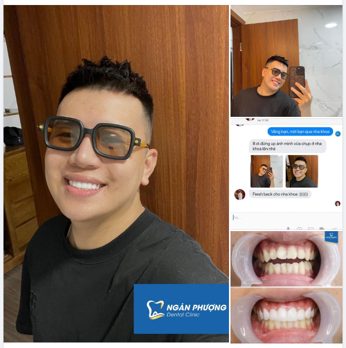 Feedback cực cháy cực fresh từ anh Nguyễn Huy
