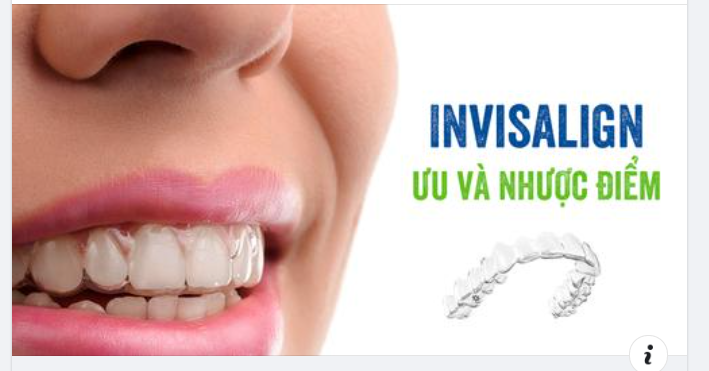 Niềng Răng Bằng Invisalign So Với Niềng Răng Truyền Thống