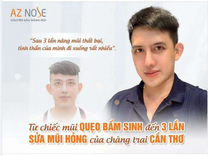 Câu chuyện về 100 triệu đồng được chi và 3 lần nâng mũi bị l.ỗi của chàng trai 9X