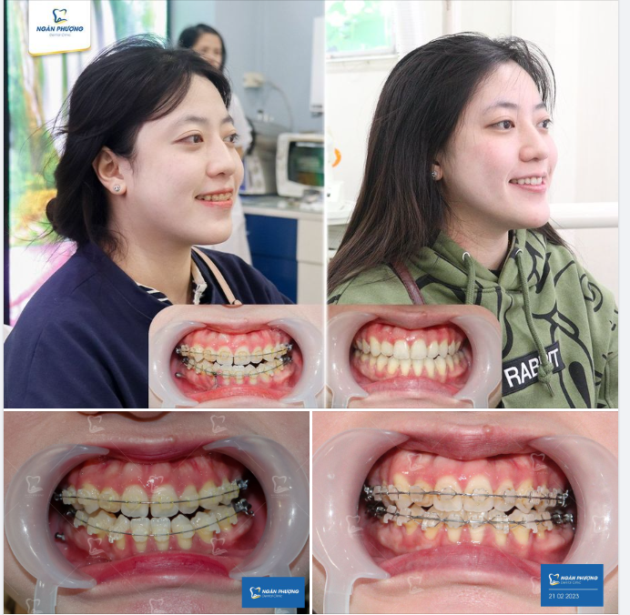 Chúc mừng Thuỳ Trang với thành quả ngọt ngào sau hơn 1 năm nỗ lực