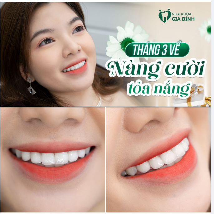 ĐỪNG BỎ LỠ CƠ HỘI NHẬN ƯU ĐÃI CỰC KHỦNG CÙNG NỤ CƯỜI TỎA NẮNG NHÂN DỊP 8/3