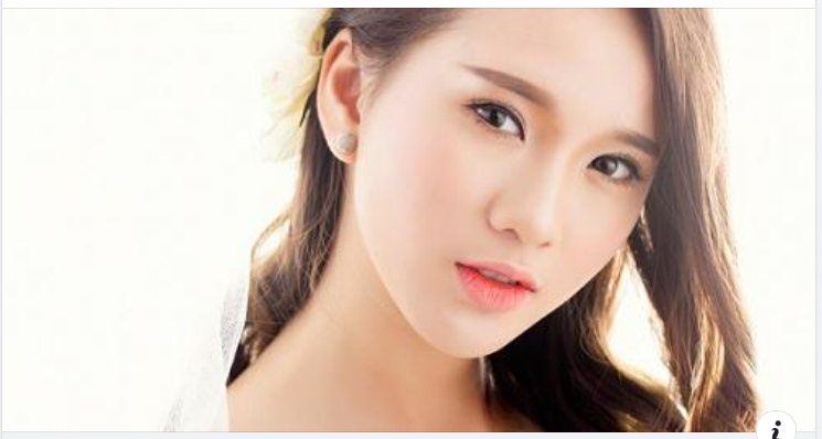 Phẫu thuật độn cằm v line được rất nhiều chị em lựa chọn khi muốn định hình khuôn mặt v line.