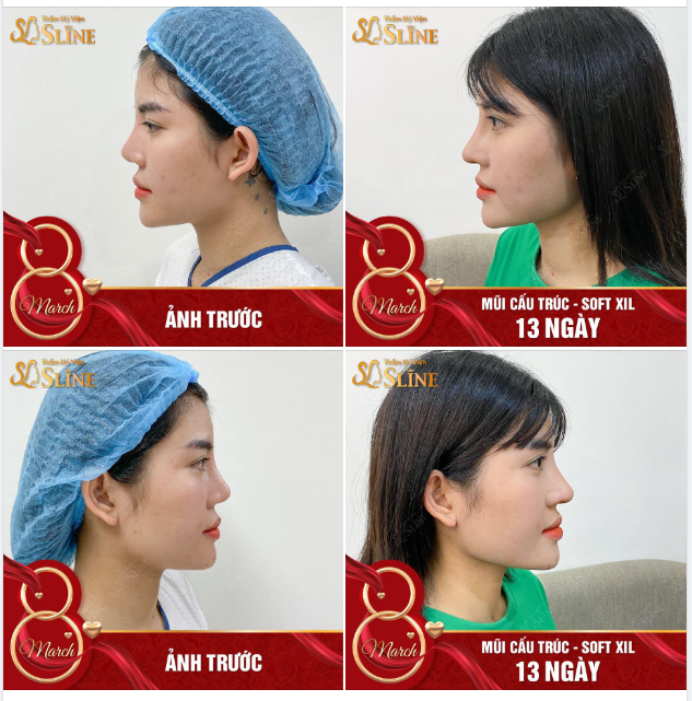 VẪN LÀ GÓC NGHIÊNG NHƯNG NÓ LẠ LẮM!!