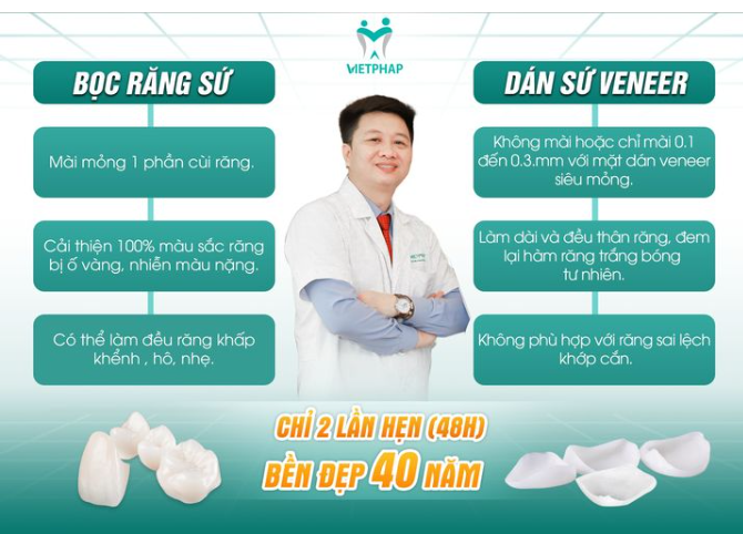 BỌC RĂNG SỨ HAY DÁN SỨ VENEER?