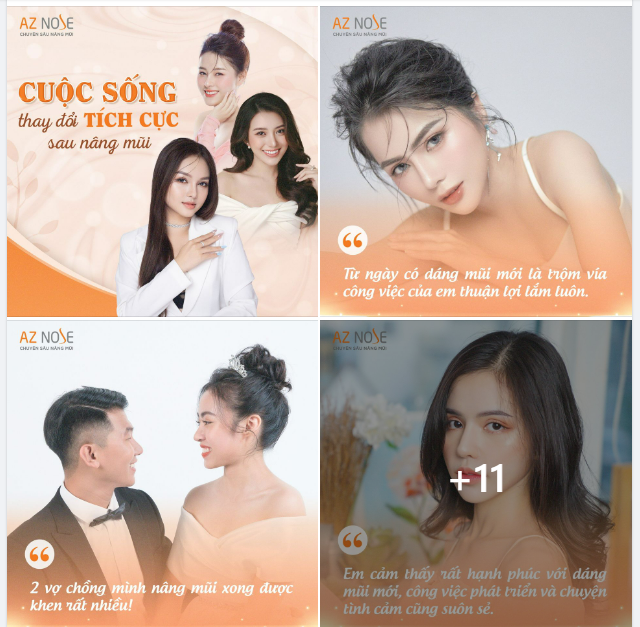 Cuộc sống có "thật sự" thay đổi tích cực sau khi nâng mũi?