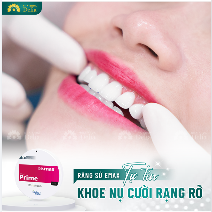 Chỉ sau 2 buổi hẹn bọc răng sứ cao cấp Emax, khách hàng sở hữu nụ cười khỏe mạnh, rạng rỡ!