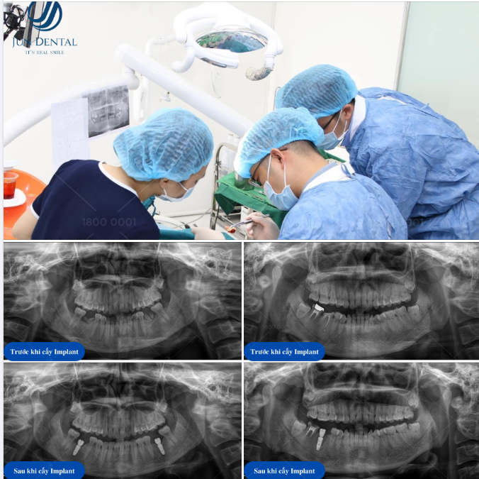 LẤY LẠI CHỨC NĂNG CHO HAI VỊ KHÁCH VÀO NGÀY THỨ 3