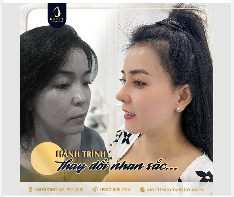 Hành trình thay đổi bản thân. Nhìn lại những hình ảnh trước khi làm phẫu thuật của mình, chị khách vẫn không hết bất ngờ vì sự thay đổi kỳ diệu này.