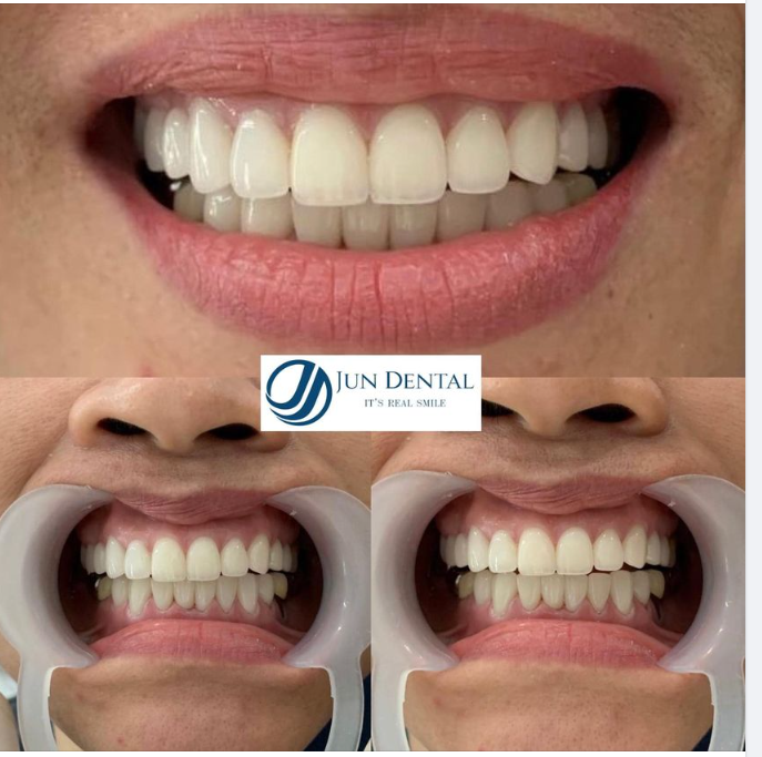 MỒNG MỘT THIẾT KẾ NỤ CƯỜI MỚI BỪNG SÁNG - XOÁ TAN TỰ TI TỪ BÊN TRONG