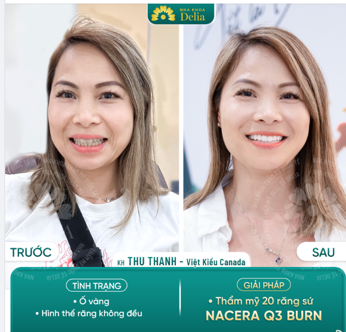Chỉ mất 2 ngày về nước - Việt Kiều Canada sở hữu nụ cười rạng rỡ