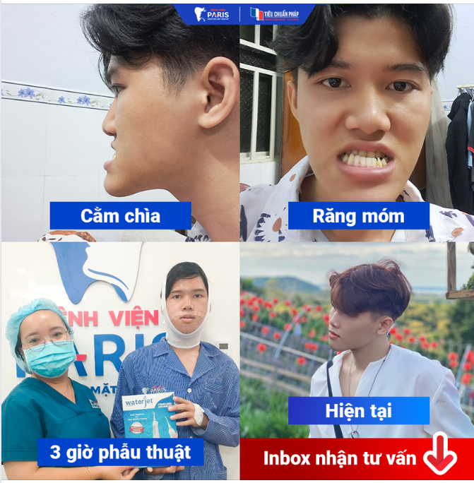 TIN ĐƯỢC KHÔNG???