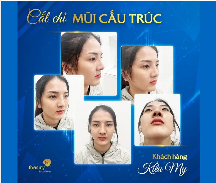 Minh chứng rõ nét nhất cho chất lượng dịch vụ tại mỗi địa chỉ làm đẹp là sự hài lòng và những hình ảnh tuyệt vời từ phía khách hàng.