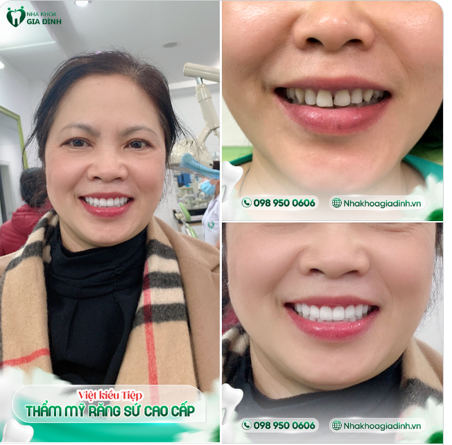 VỀ VIỆT NAM TÂN TRANG NỤ CƯỜI MỚI!