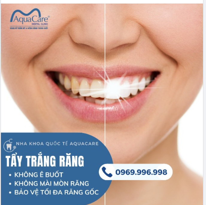 MỘT NGÀY ĐẸP TRỜI ĐỂ TẨY TRẮNG RĂNG
