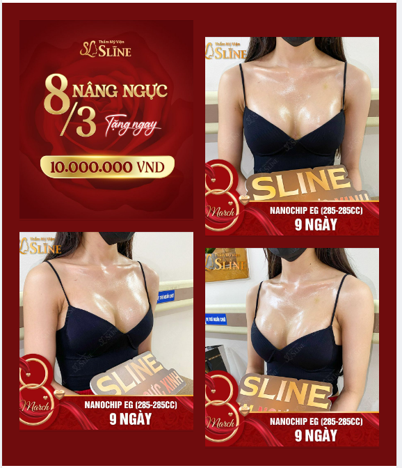 NGỰC ĐẸP NGAY - 10 TRIỆU CẦM TAY