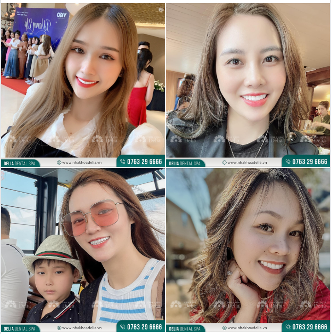 Hoa chỉ cần đủ nắng thì sẽ nở, phụ nữ chỉ cần nở nụ cười tươi mỗi ngày sẽ trở nên xinh đẹp và cuốn hút.